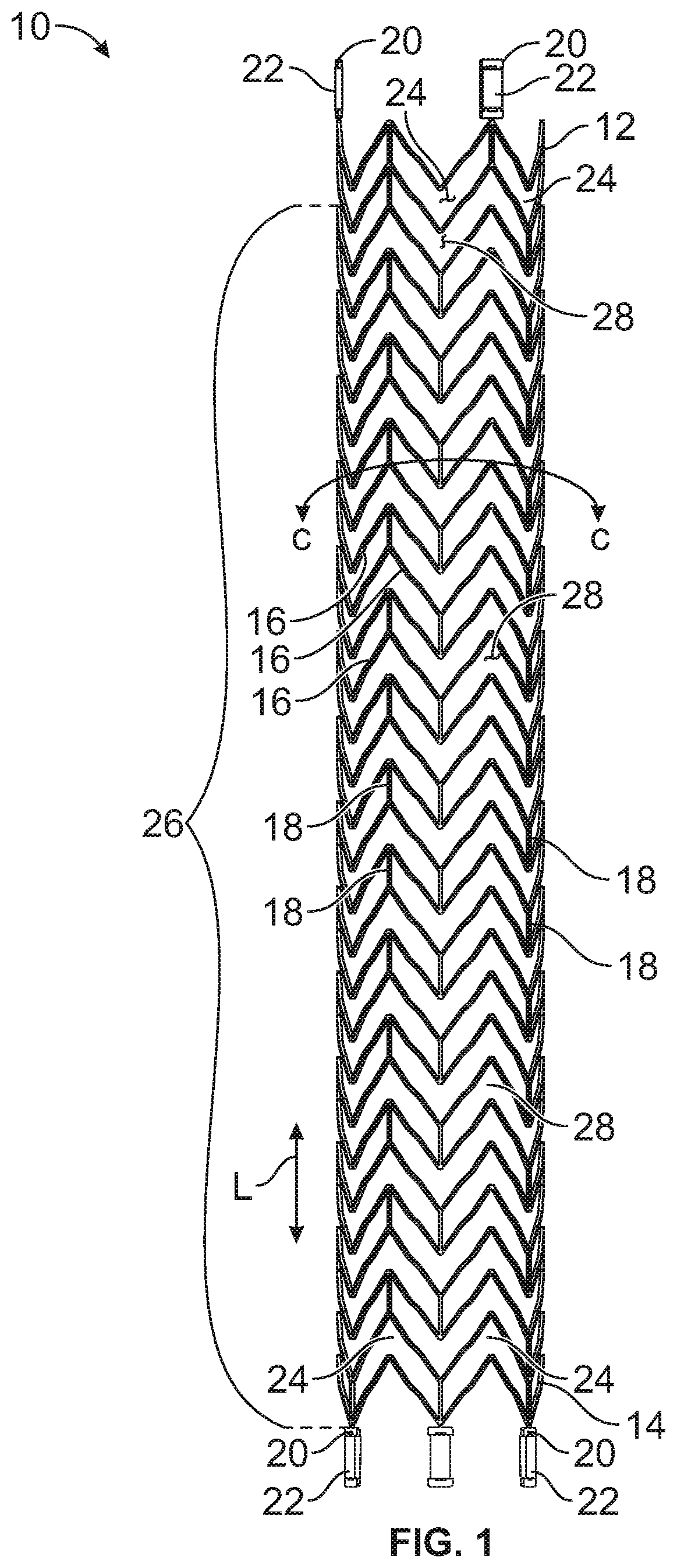 Stent and method of making same