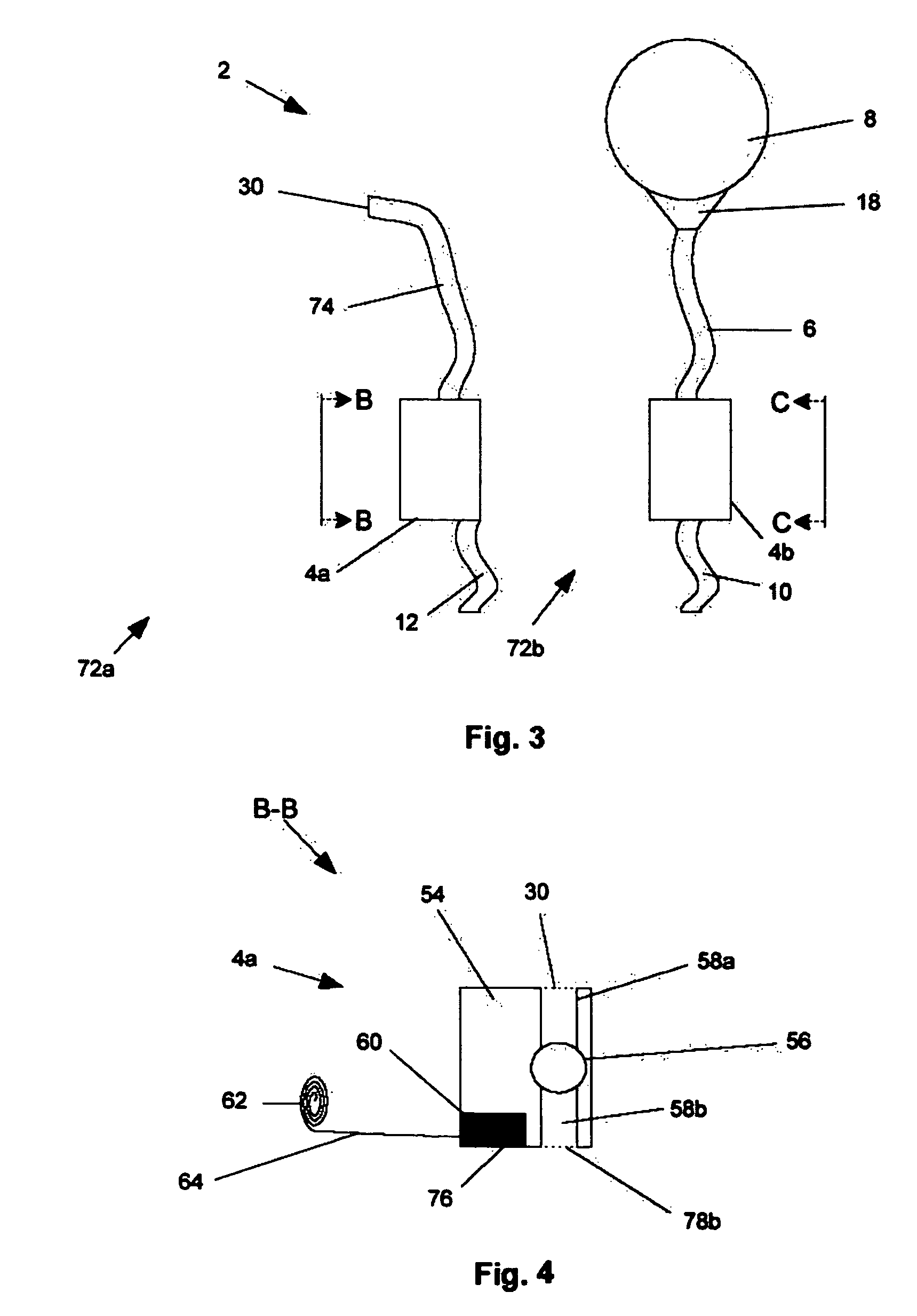 Dialysis implant and methods of use