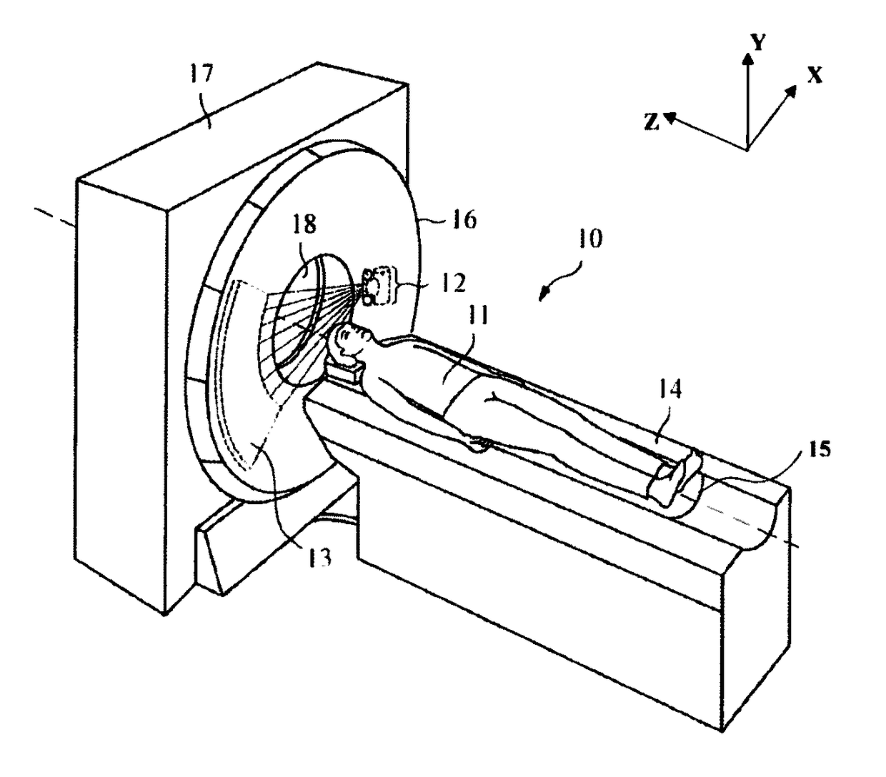 Automatic detection of patient body profile and intelligent positioning of patient