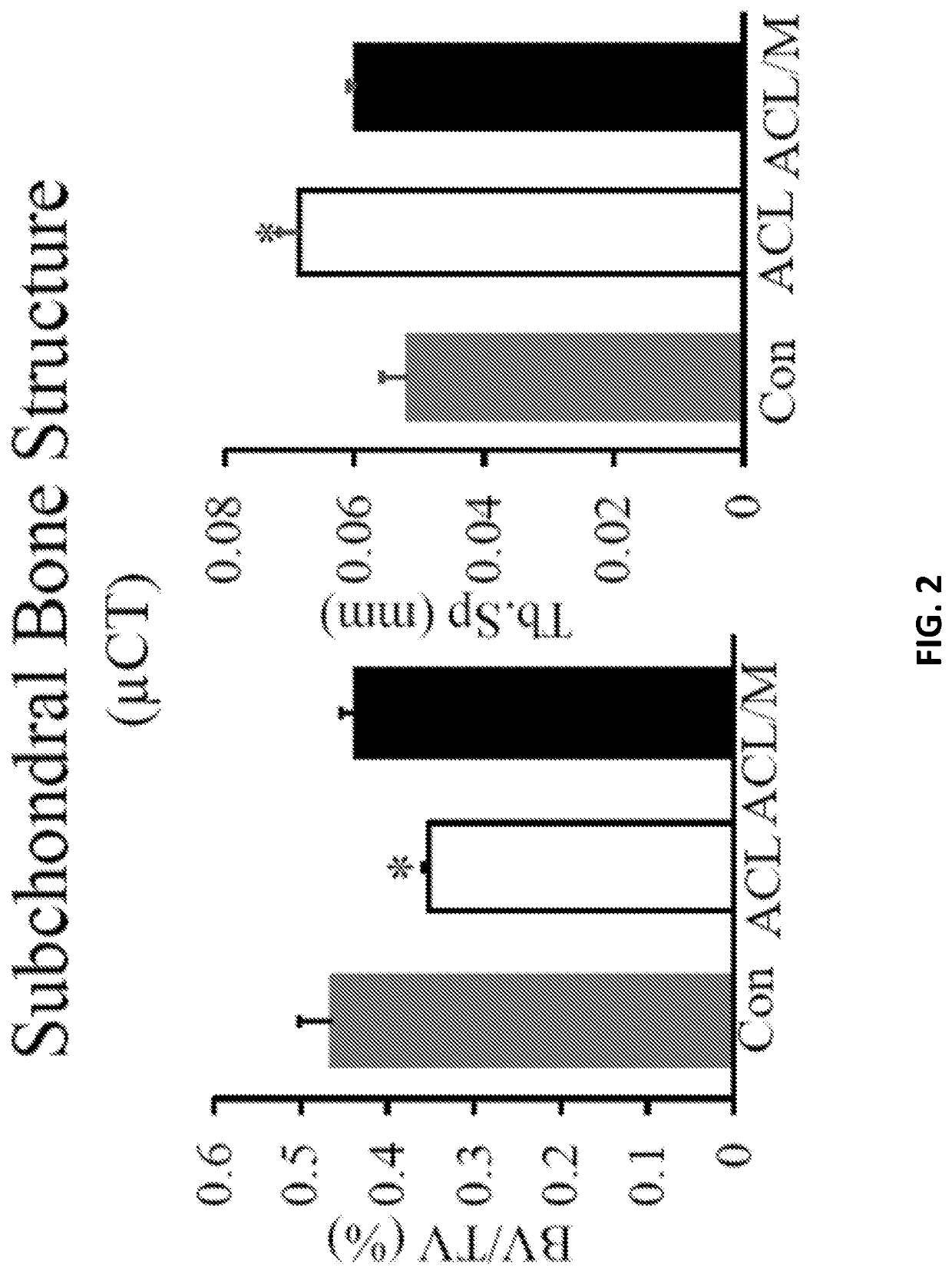 Prevention and Treatment of Osteoarthritis by Inhibition of Insulin Growth Factor-1 Signaling