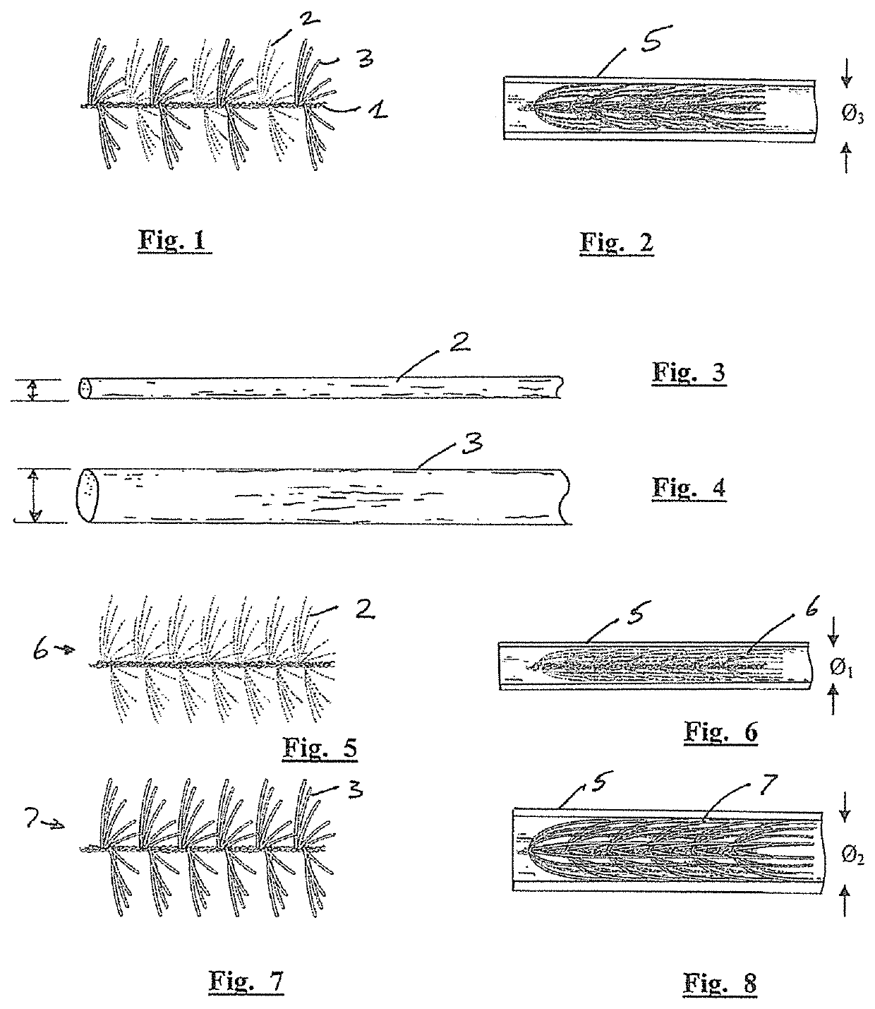 Embolisation systems