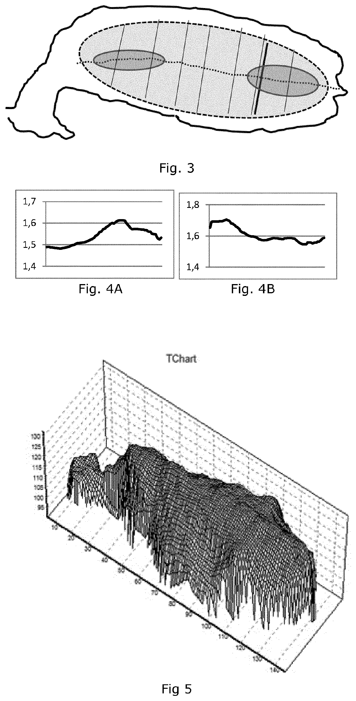 System and method for identification of individual animals based on images of the back