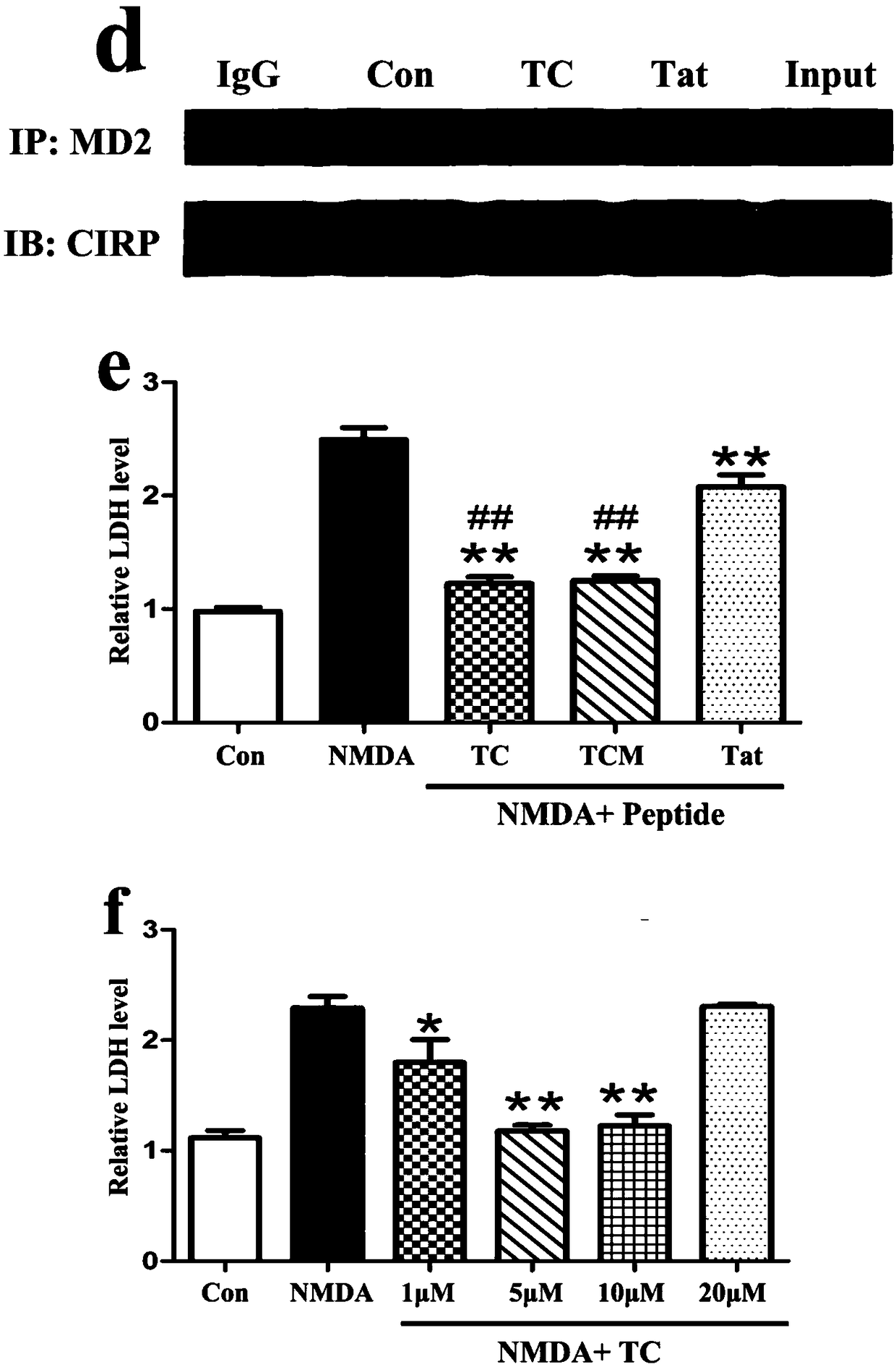 Short chain polypeptide capable of inhibiting binding of MD2 and CIRP protein and application of short chain polypeptide