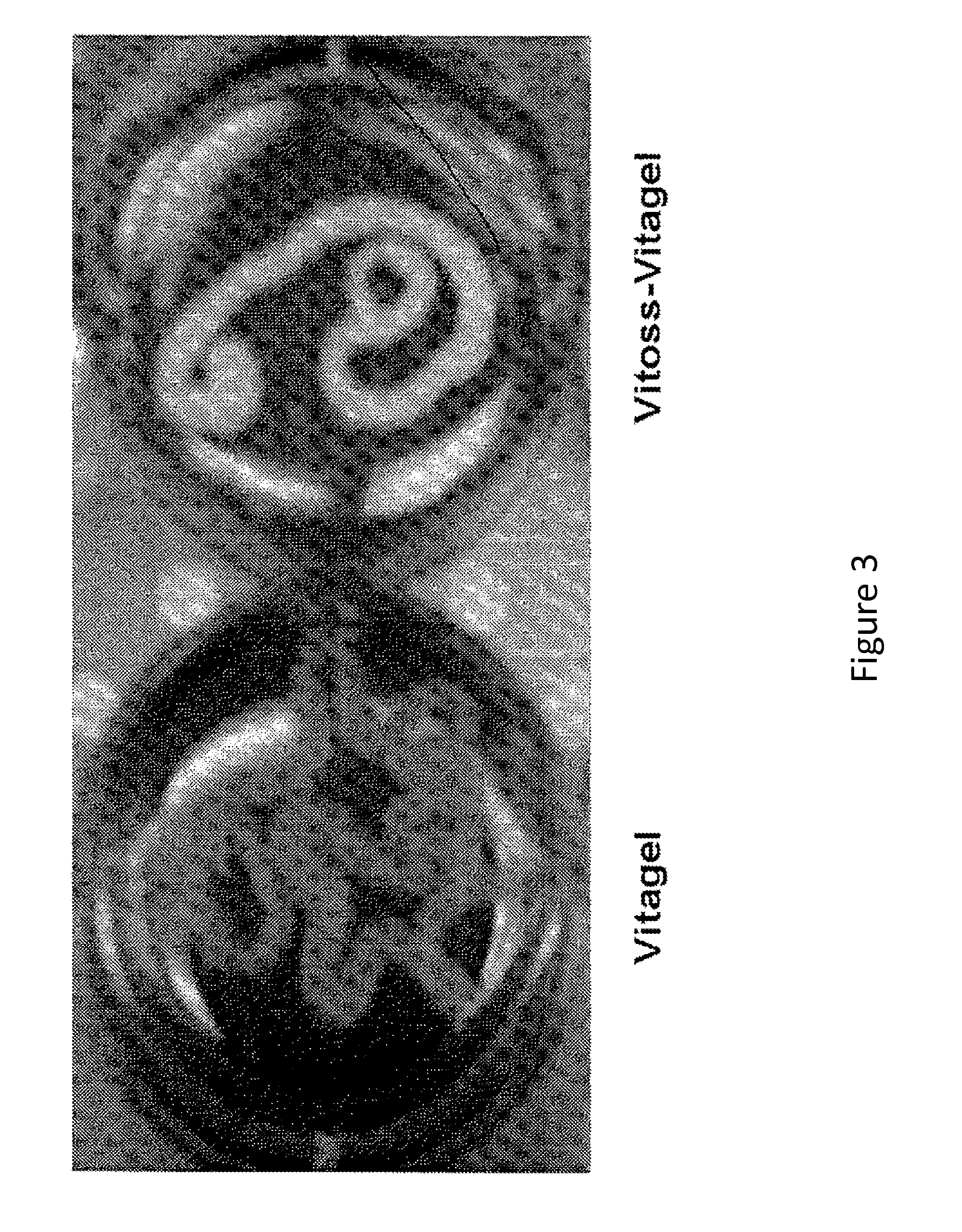 Biomaterial Compositions and Methods of Use