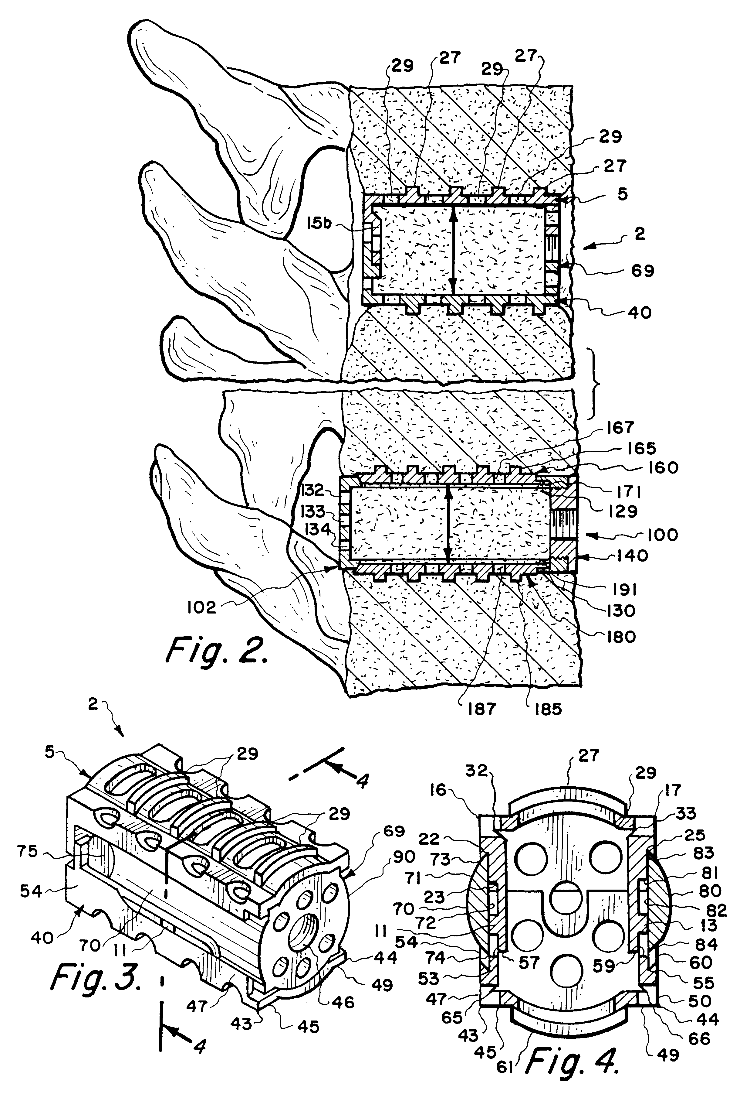 Expandable spinal implants
