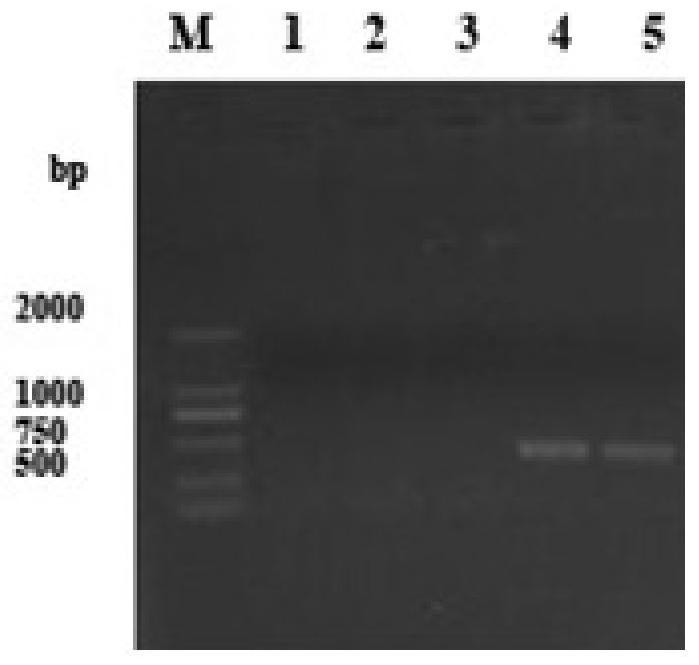 A kind of recombinant mycobacterium smegmatis strain of knocking out c-di-amp decomposing enzyme and its application
