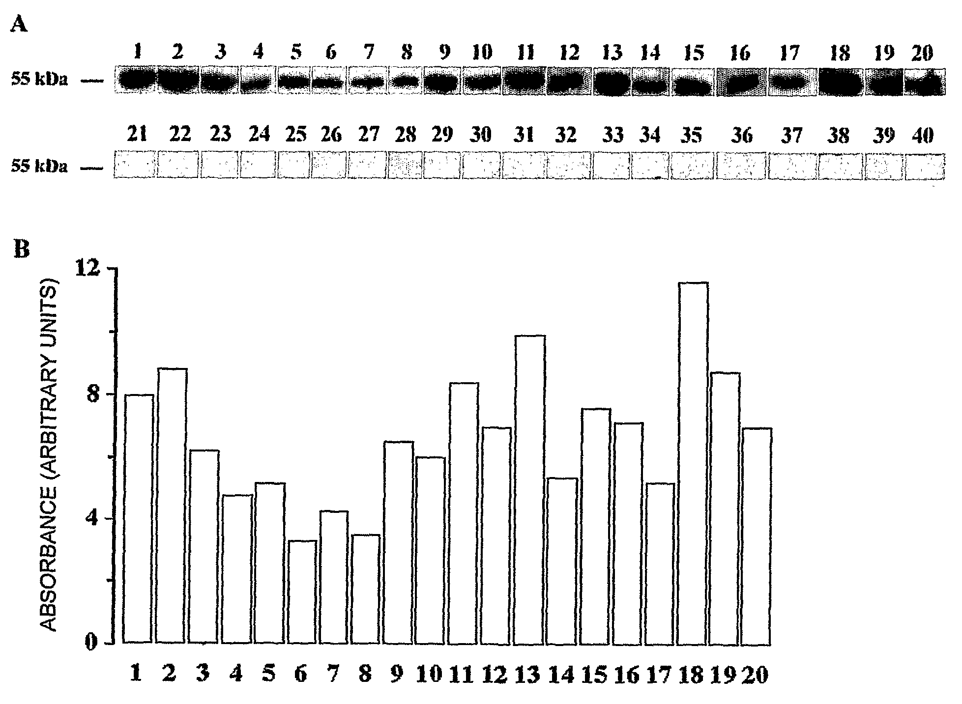 Use of the salivary protein CD14 as an indicator of the low risk to developing dental caries