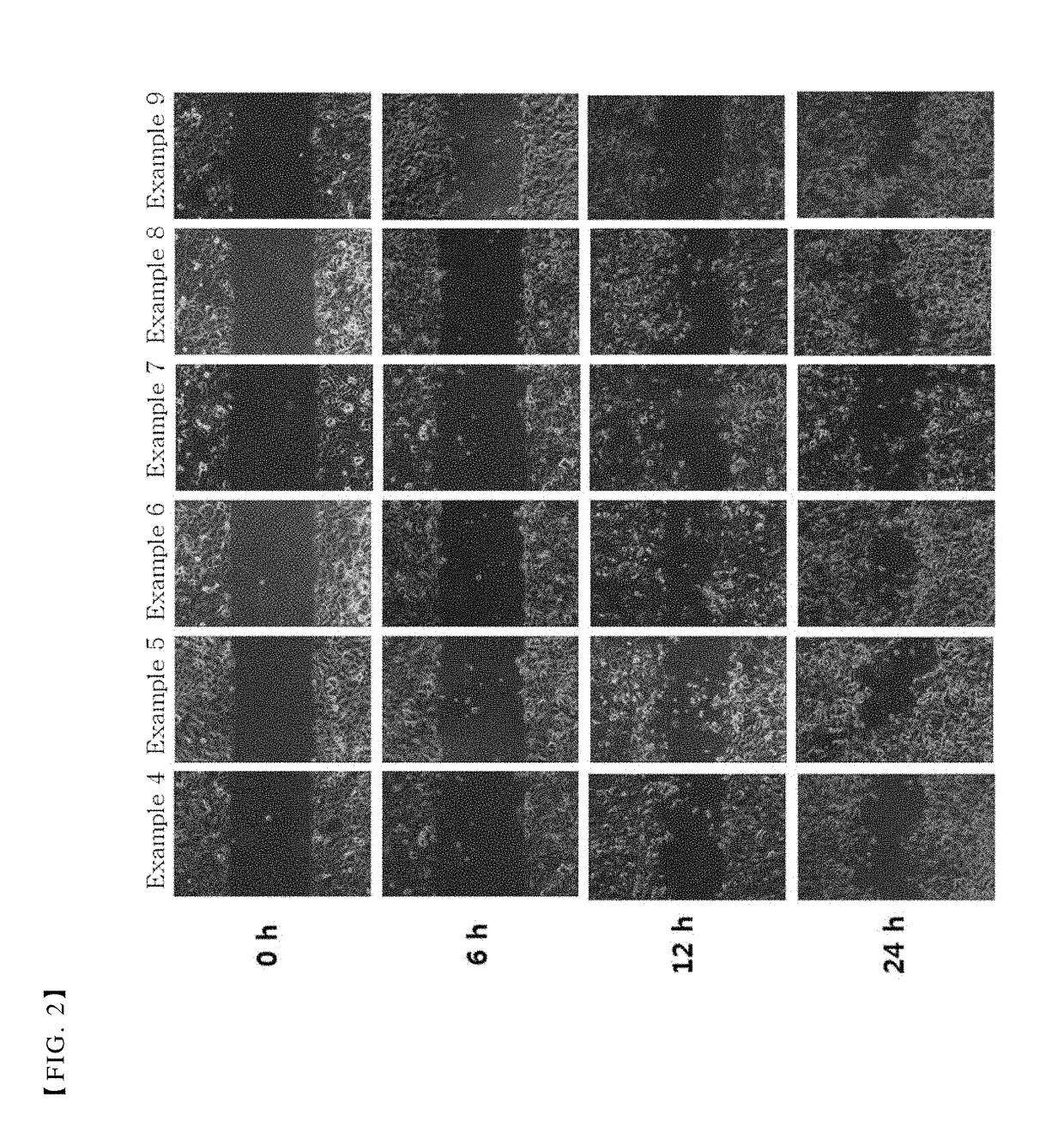 Pharmaceutical composition for treating or preventing corneal wound comprising thymosin β4 and citric acid