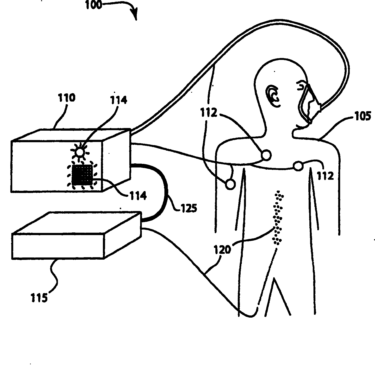 System and method of modular integration of intravascular gas exchange catheter with respiratory monitor and ventilator