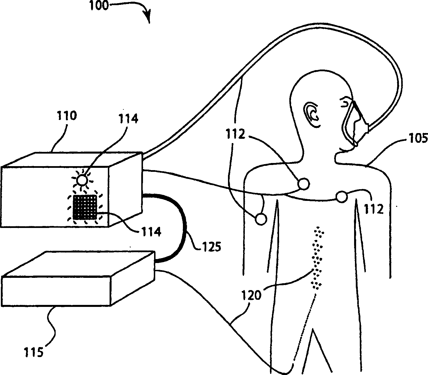 System and method of modular integration of intravascular gas exchange catheter with respiratory monitor and ventilator