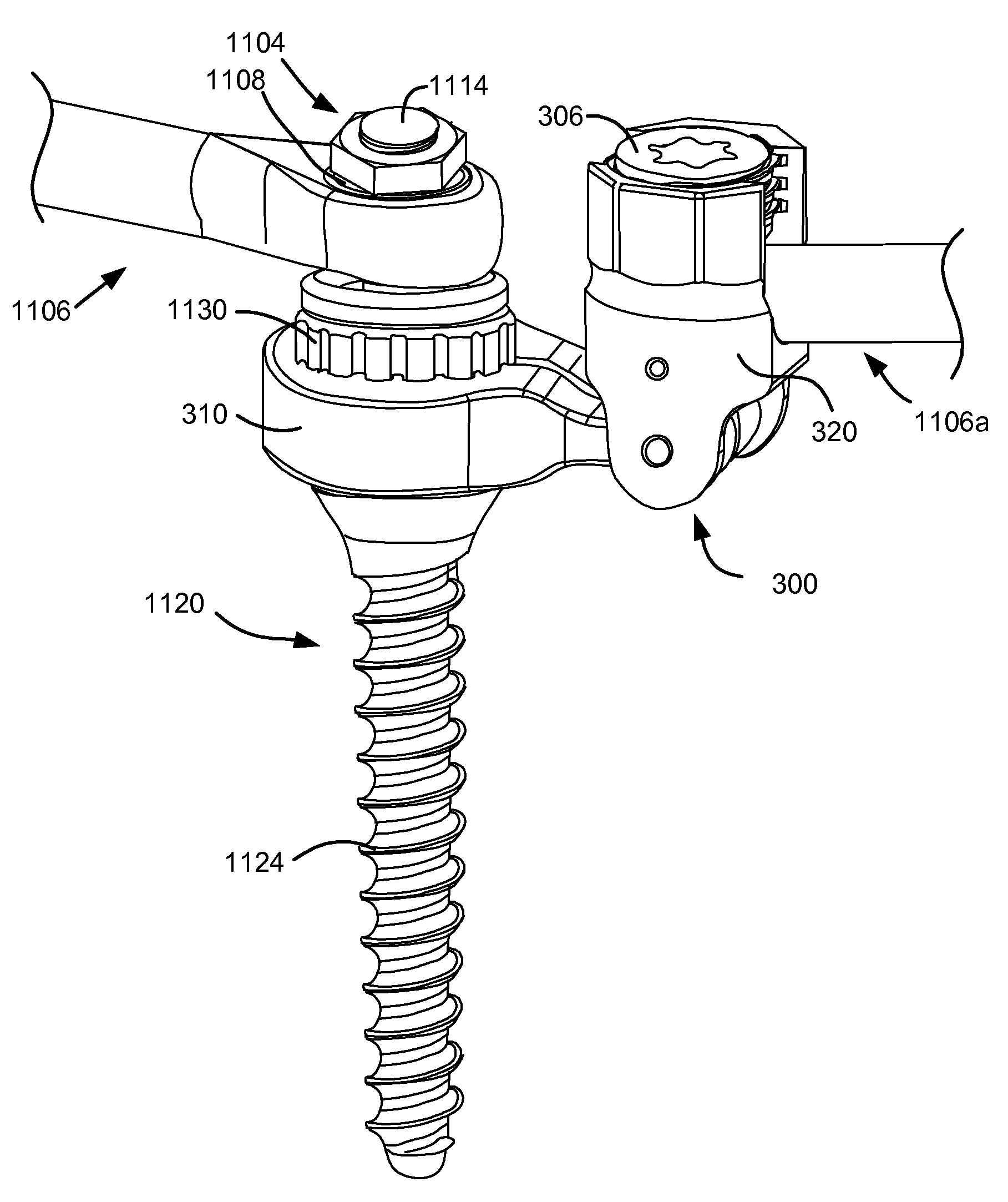 Versatile polyaxial connector assembly and method for dynamic stabilization of the spine