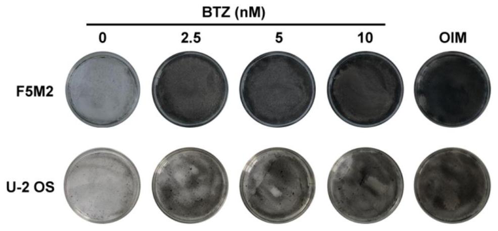 Application of bortezomib in preparation of medicine for treating osteosarcoma