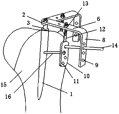 Bone block fixing device for proximal humerus comminuted fractures