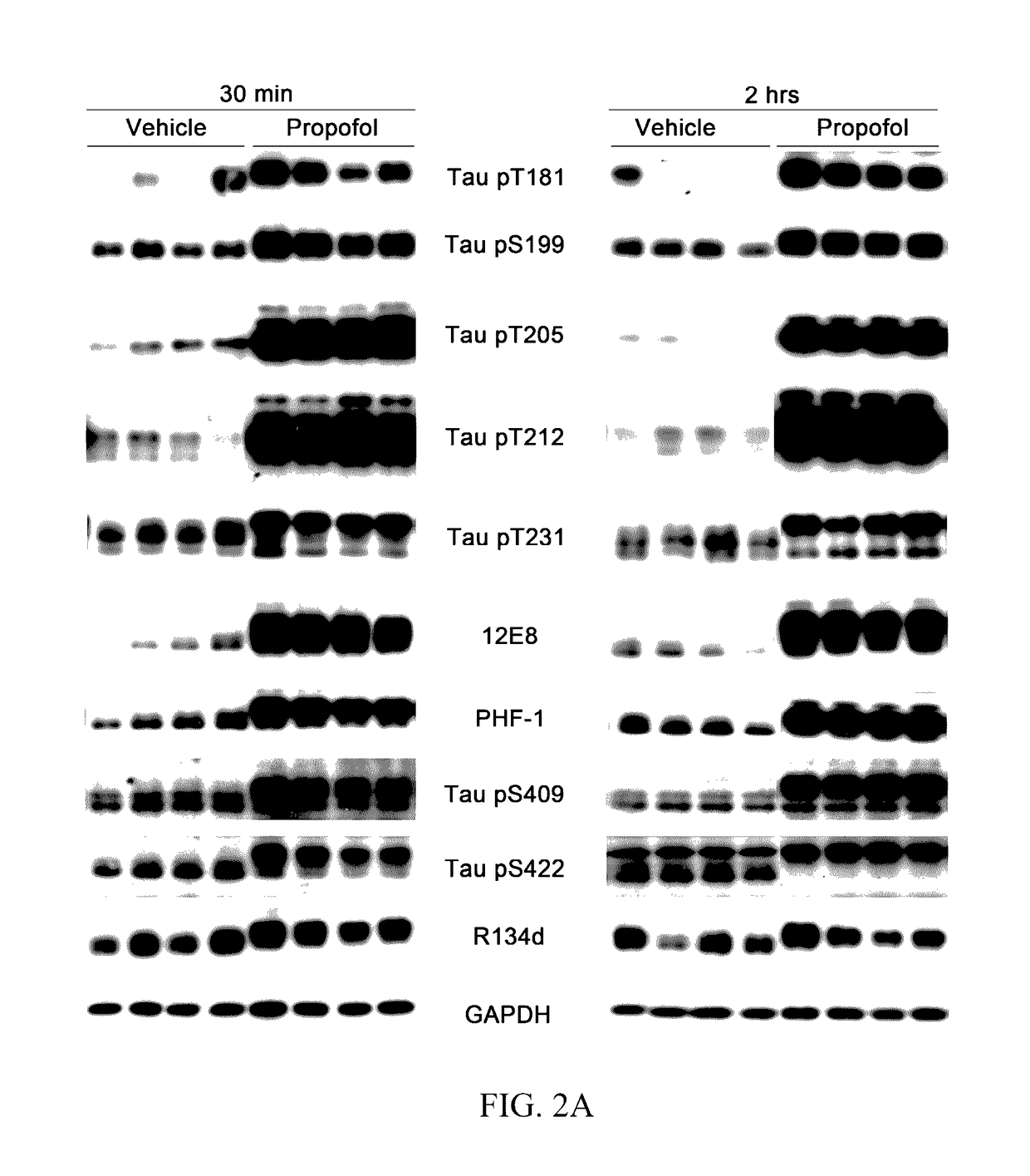 Intranasal insulin administration for the minimization of anesthesia-induced memory loss