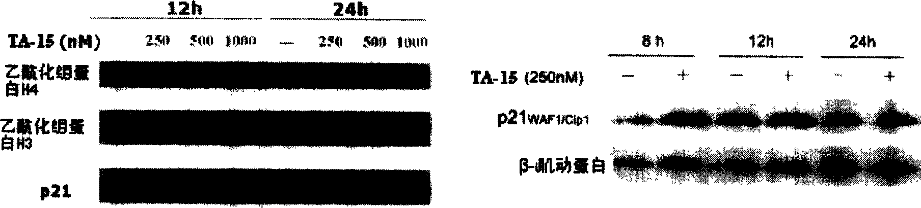 Trichostatin A derivatives, preparation method and use thereof