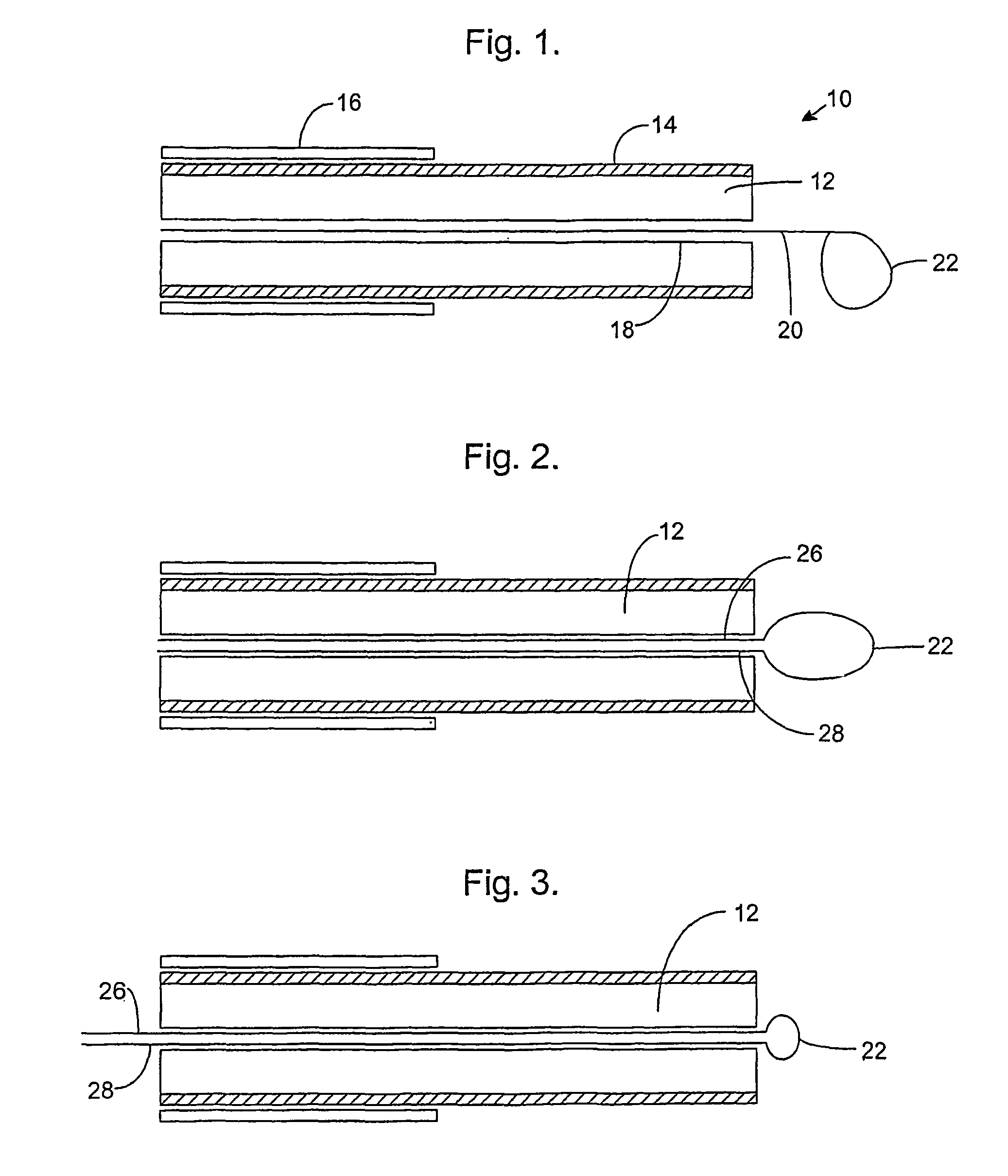 Catheter, apparatus for creating a linear ablation and a method of ablating tissue