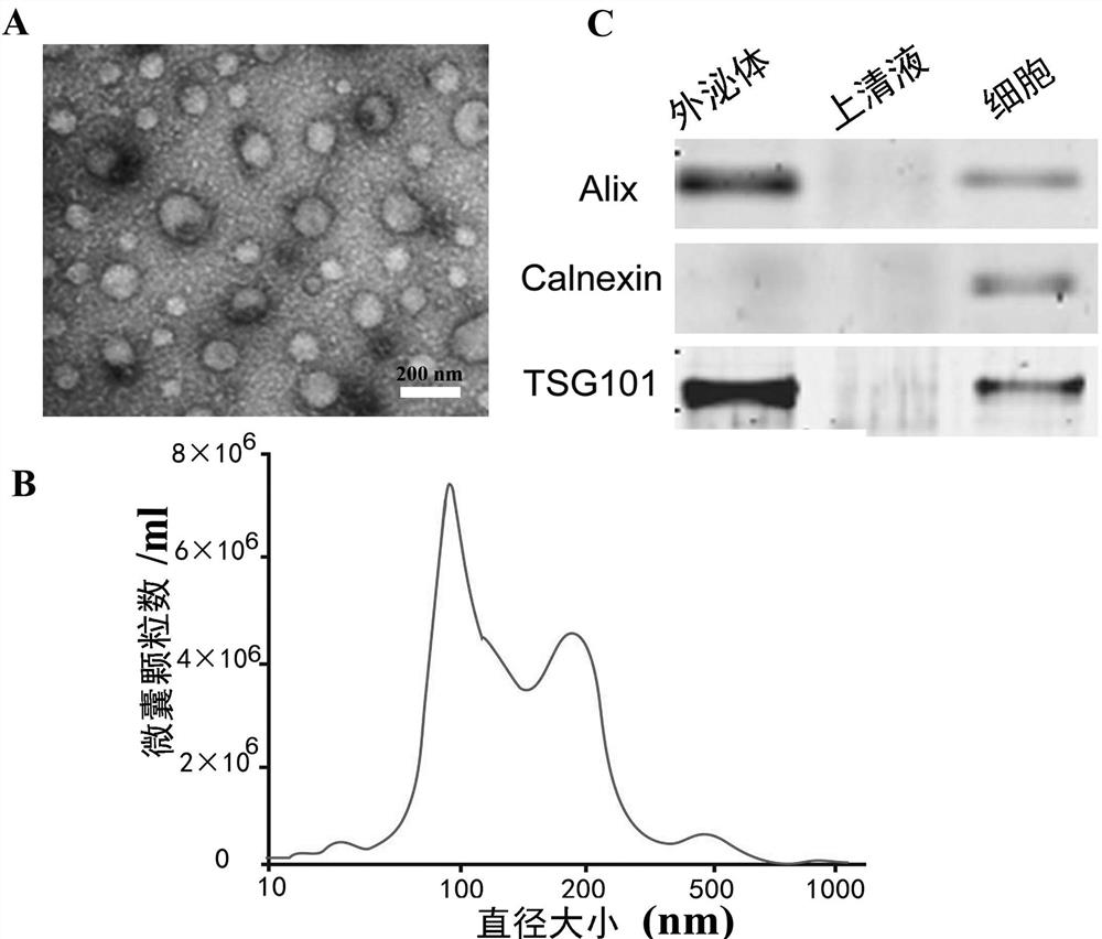 Method for inducing adipose tissue-derived stem cells to differentiate into testicular interstitial-like cells by single transcription factor