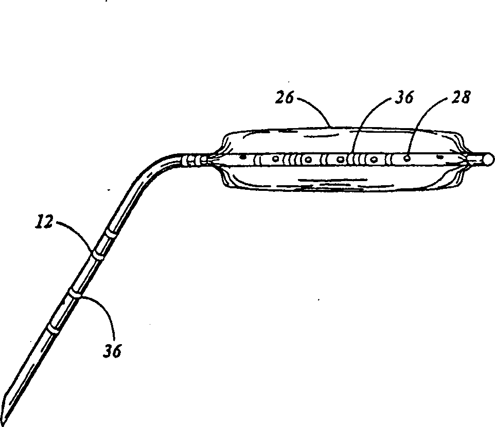 Sizing catheter for measuring septal defects