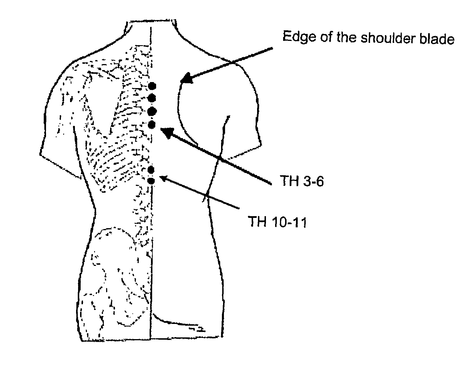 Method of determining the sympathetic tone and system for measurement thereof