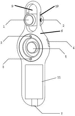 Portable digital slit lamp for cataract screening