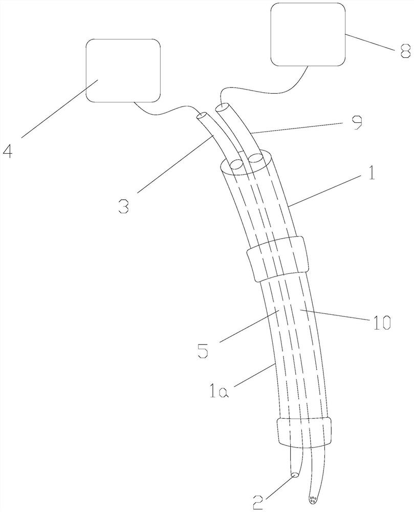 Visual intraoperative stent delivery device and intraoperative stent system thereof