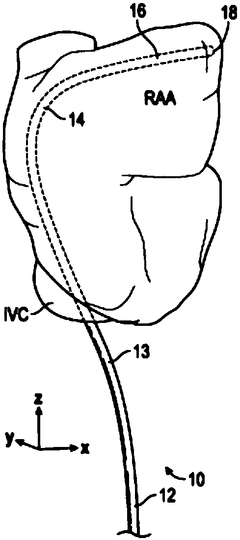 Three-dimensional right atrial appendage curve catheter