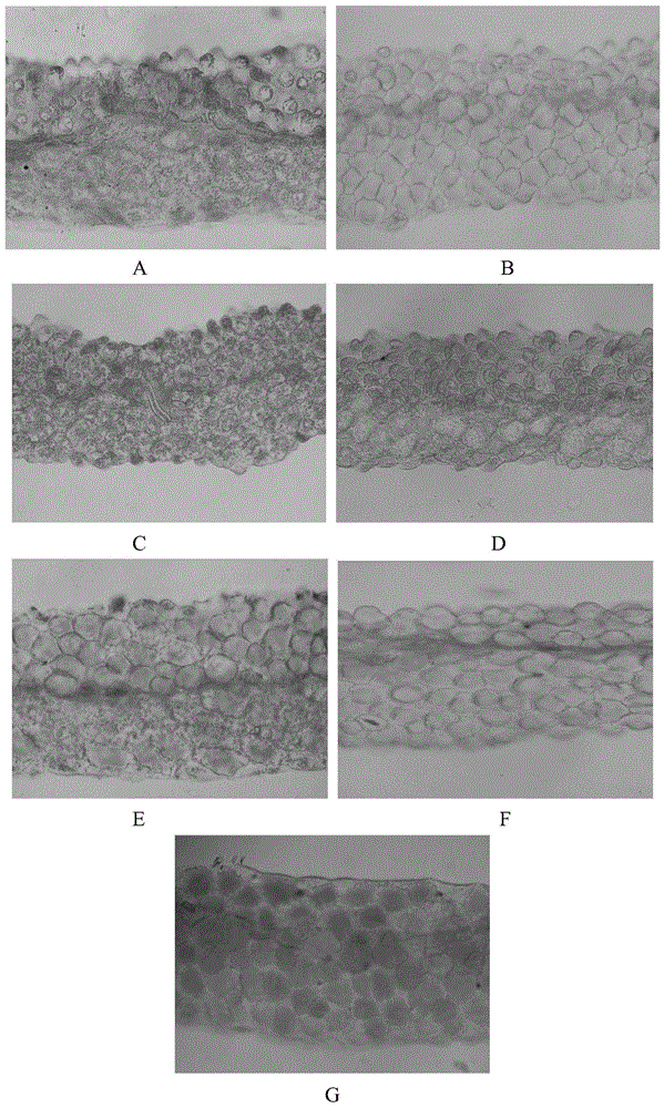 Application of interfering expression of lcyb and lcye and ectopic expression of tt8 in preparation of red petaled Brassica plants