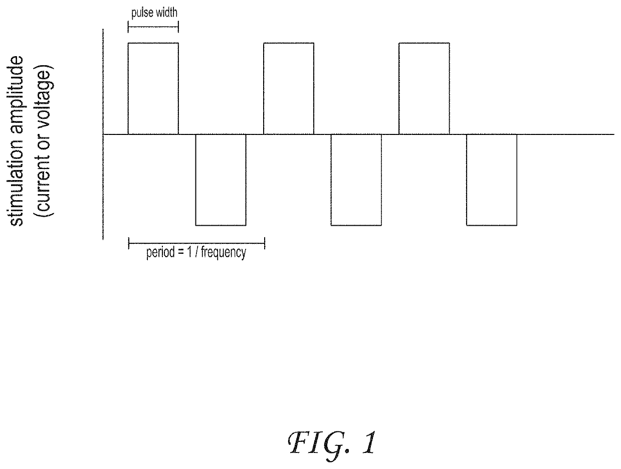 Systems and methods for treating inflammatory bowel disease through peripheral nerve stimulation