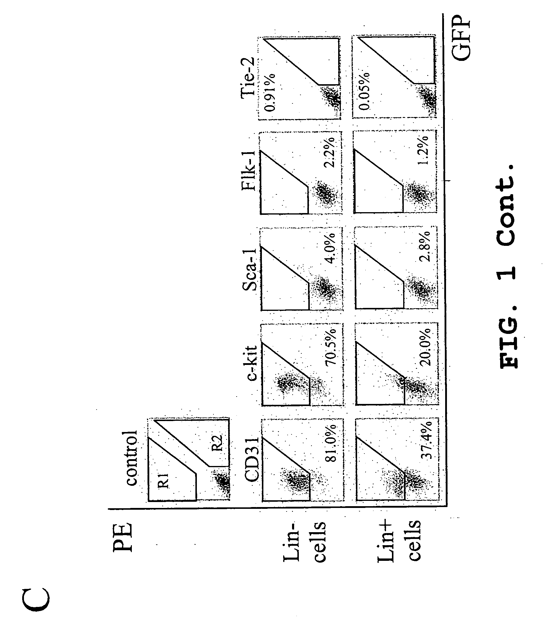 Transfected hematopoietic stem cells and methods of treatment of neovascular eye diseases therewith