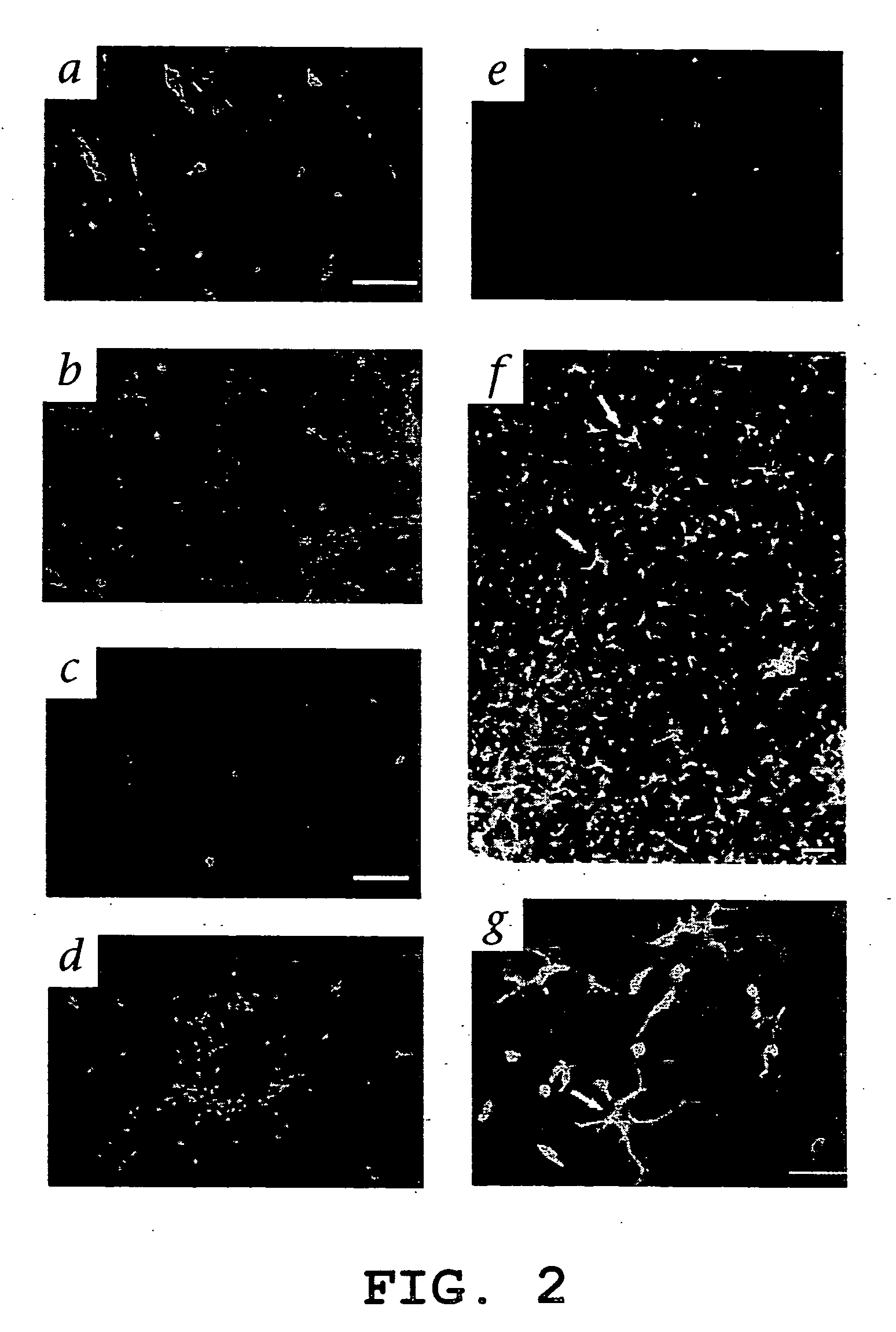 Transfected hematopoietic stem cells and methods of treatment of neovascular eye diseases therewith