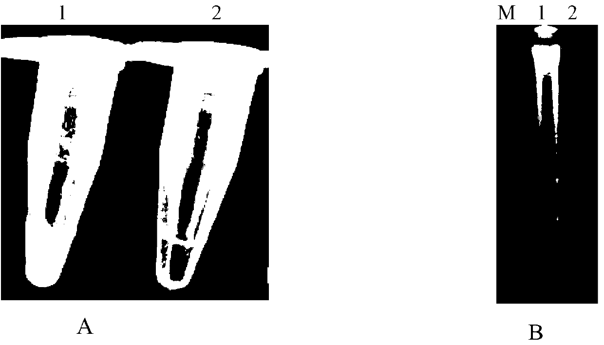 LAMP rapid detection method for Heterodera filipjevi and its application