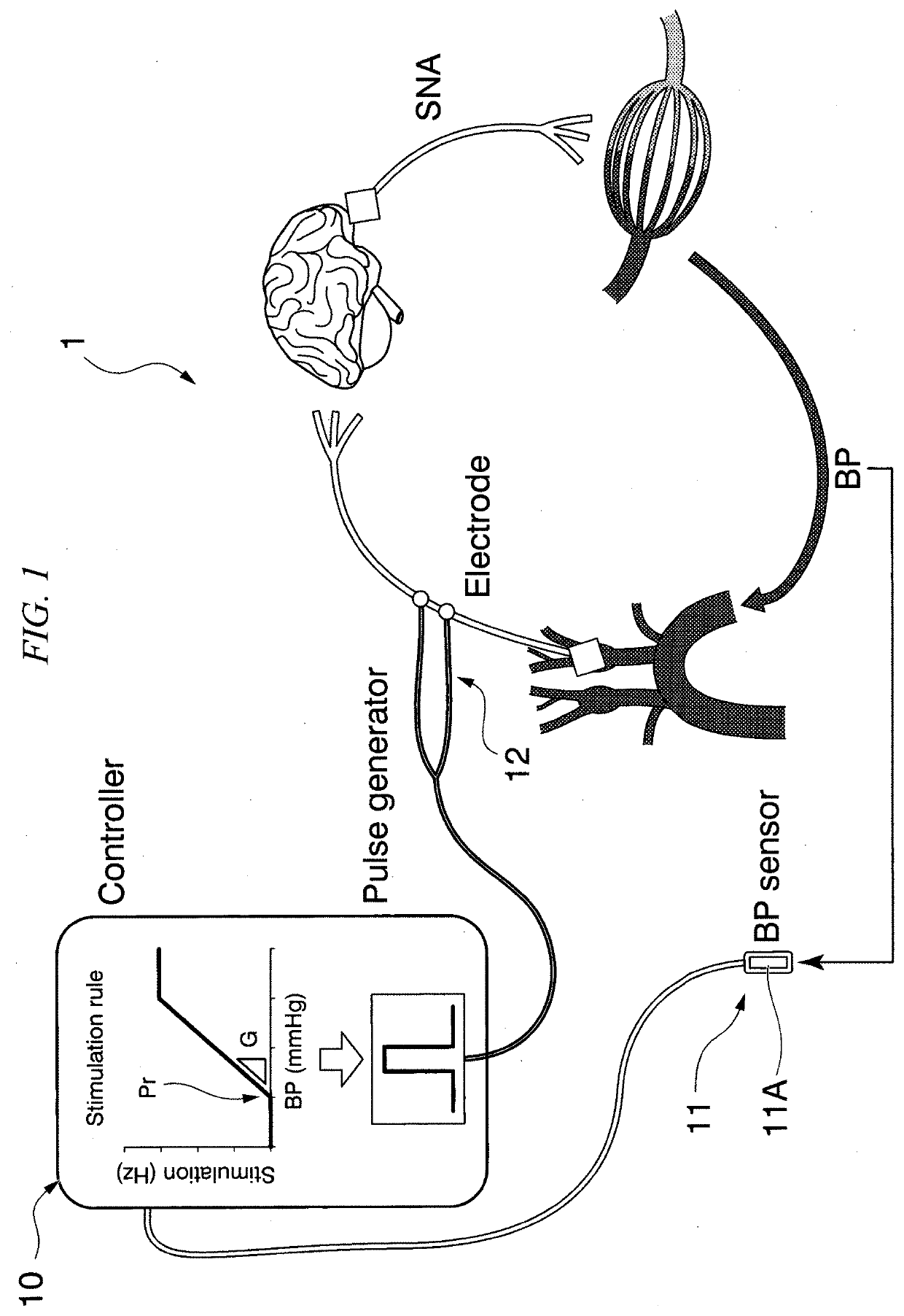 Blood pressure controlling apparatus, non-transitory computer readable recording medium storing control program of blood pressure controlling apparatus, and method for controlling blood pressure