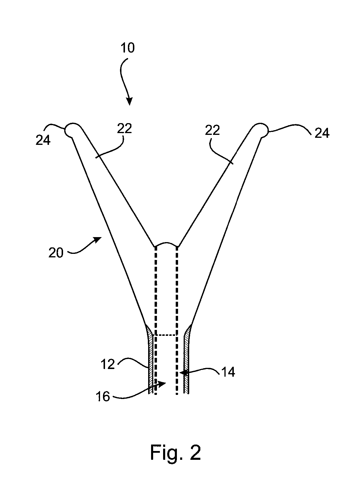 Therapeutic substance transfer catheter and method