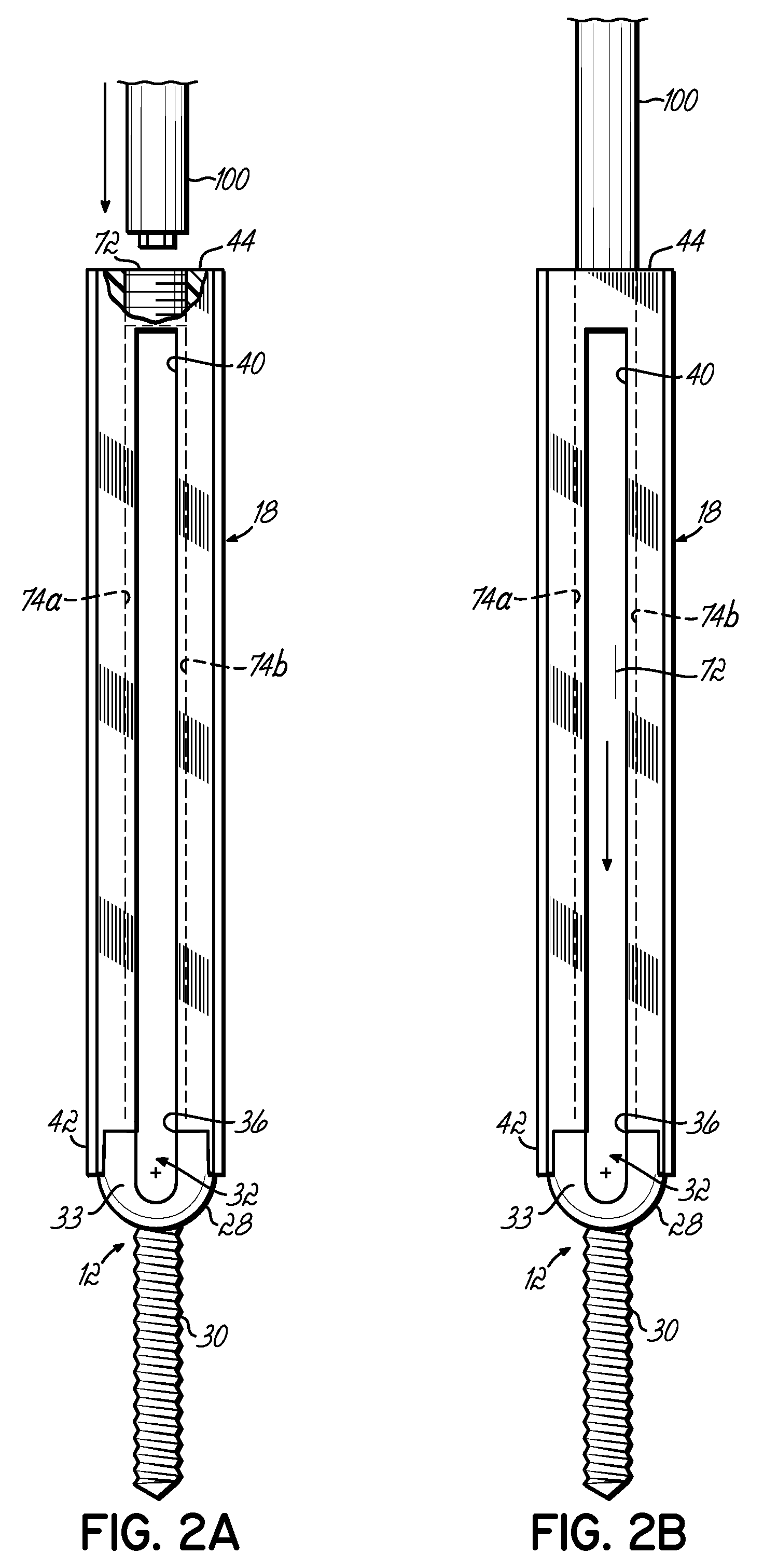 Spinal stabilization system with flexible guides