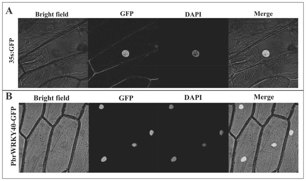 Du pear transcription factor pbrwrky40 and its application in increasing plant total acid content and genetic improvement of salt tolerance