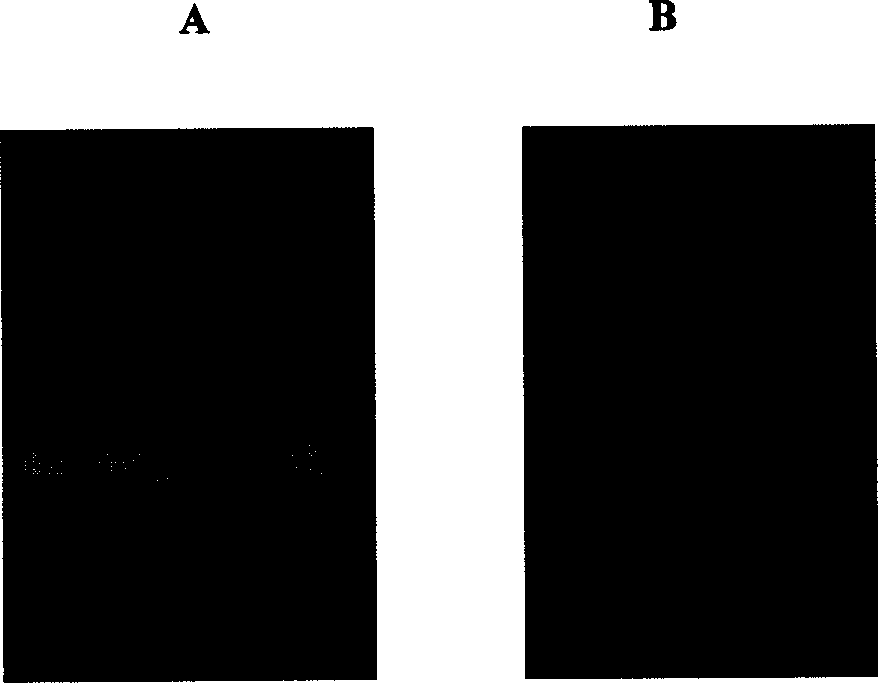 Human oral cavity epithelial proto cancer-tumor cell cDNA library and its preparing method