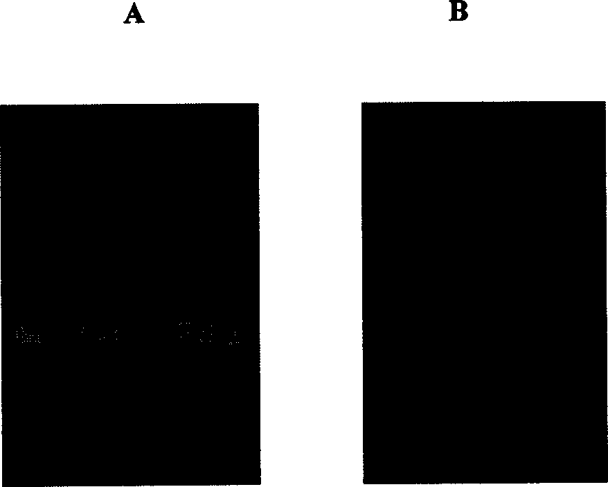 Human oral cavity epithelial proto cancer-tumor cell cDNA library and its preparing method