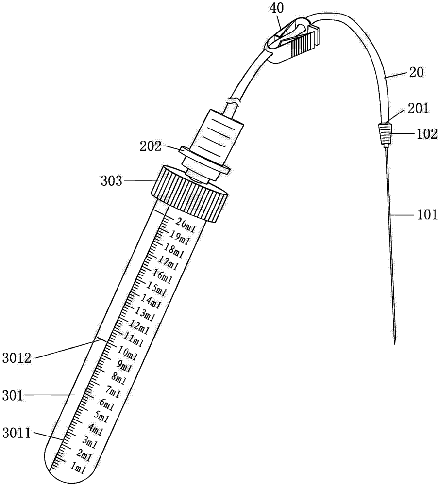 Negative pressure test tube amniocentesis device