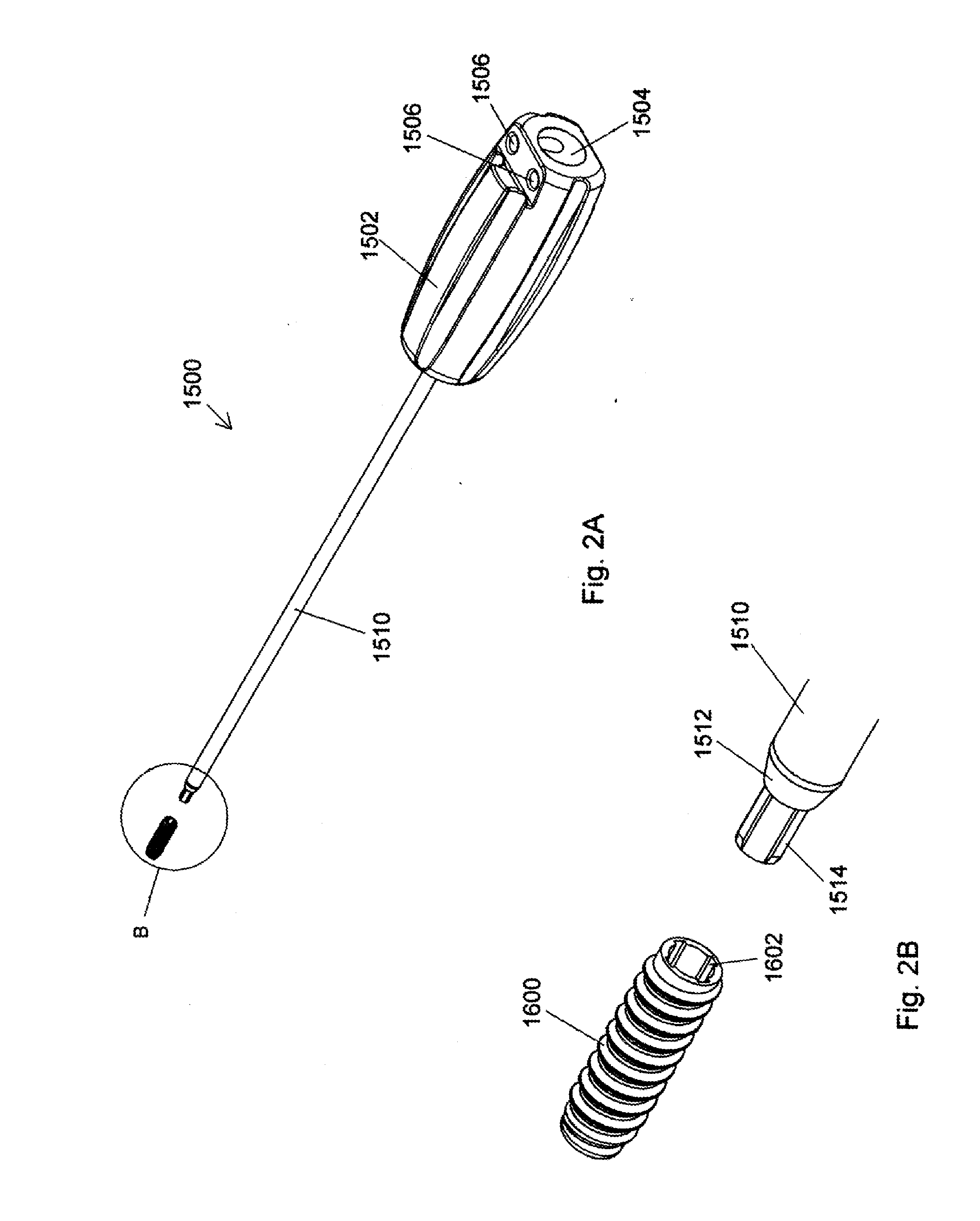 Implant placement systems, devices, and methods