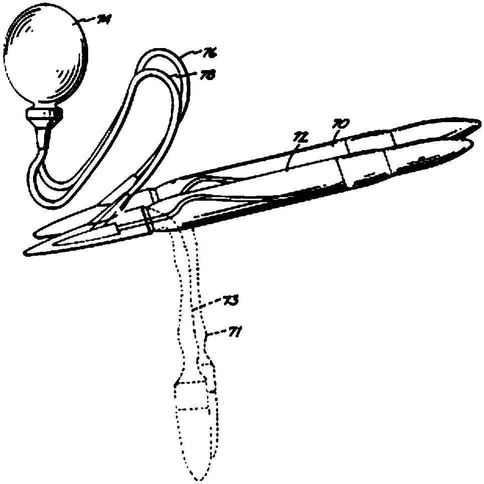 Penis pacemaker and control method thereof