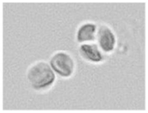 Method for segmenting adhesive algae cells in algae cell microscopic image