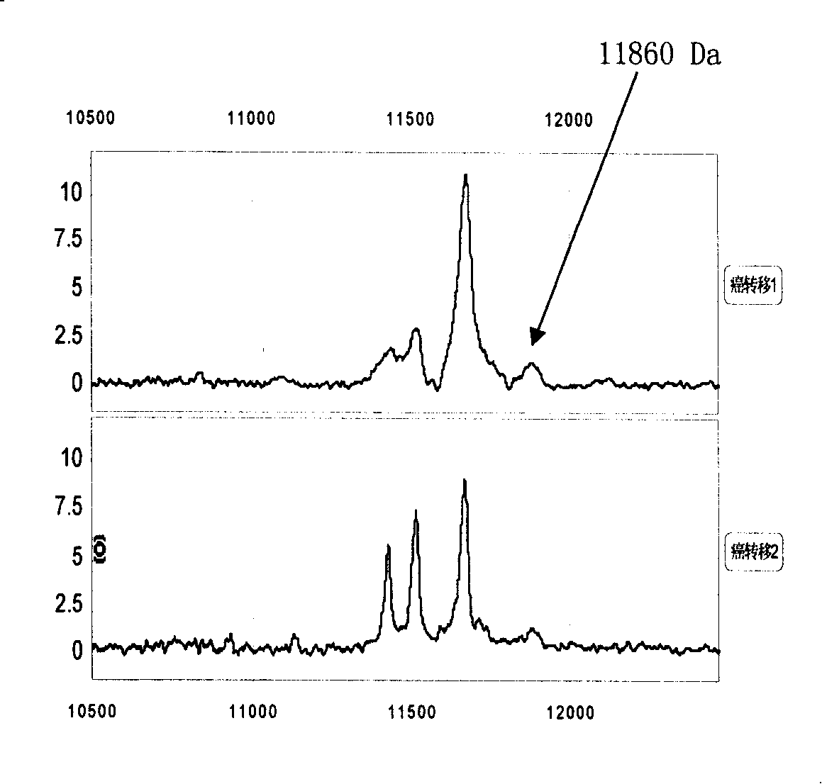 Reagent kit and method for detecting tumor recurrence and transfer and evaluating curative effect