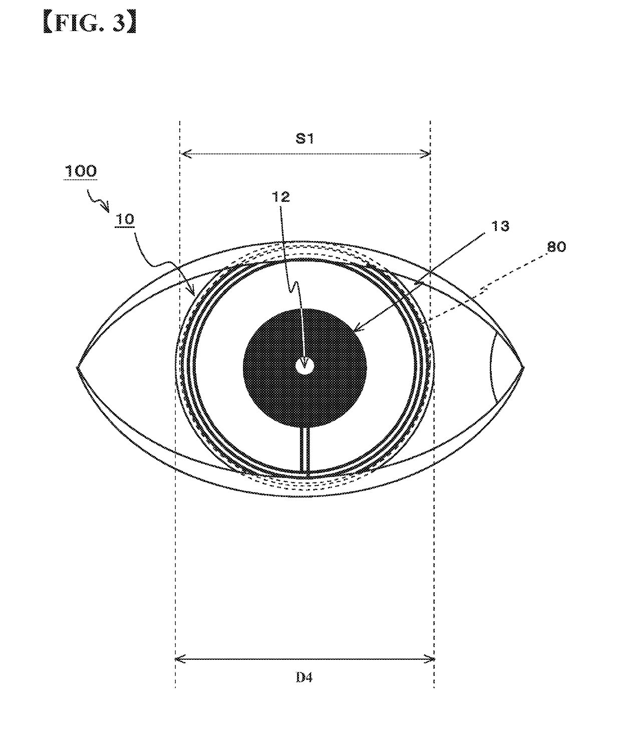 Pinhole contact lens and smart contact system