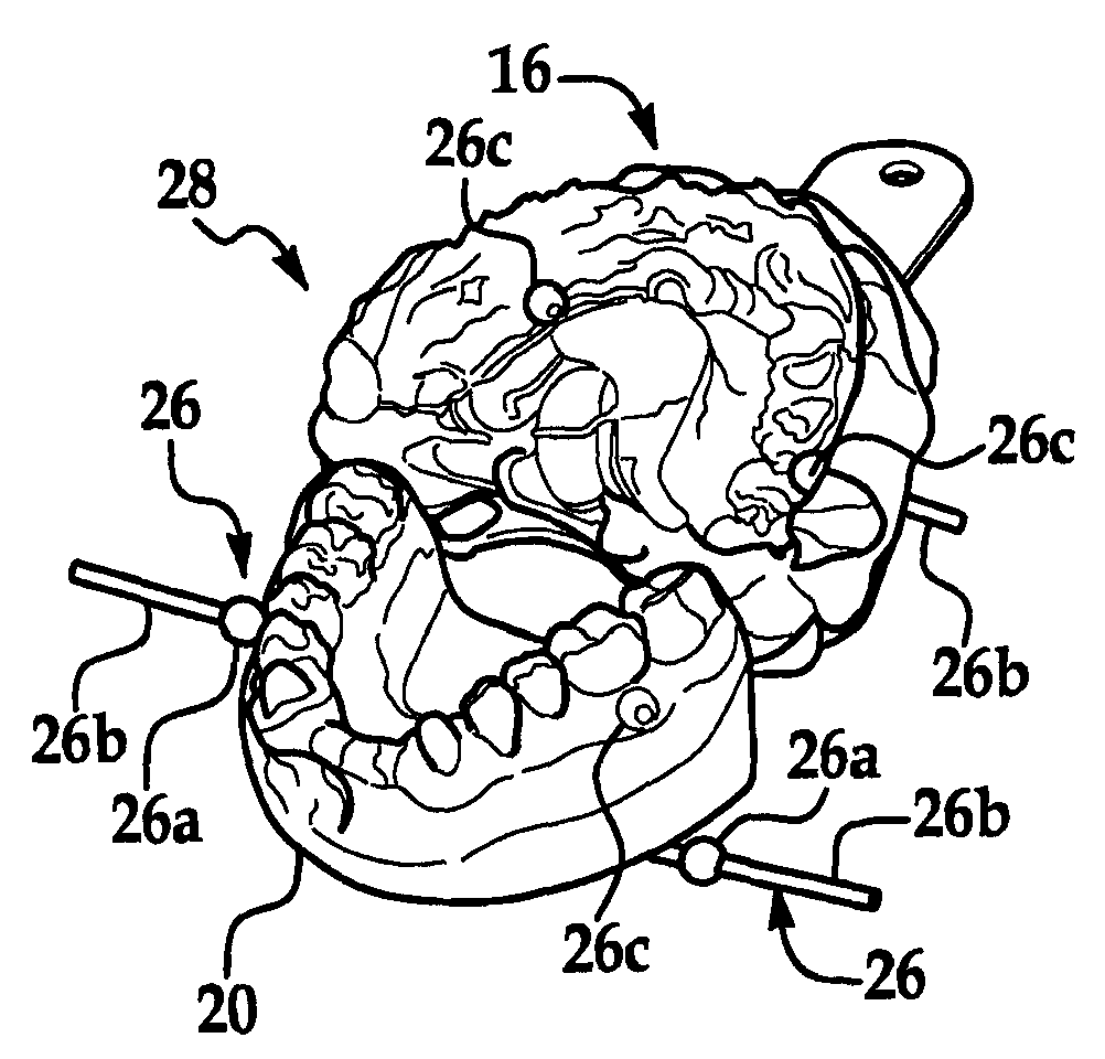 Dental device and method for linking physical and digital data for diagnostic, treatment planning, patient education, communication, manufacturing, and data transfer purposes