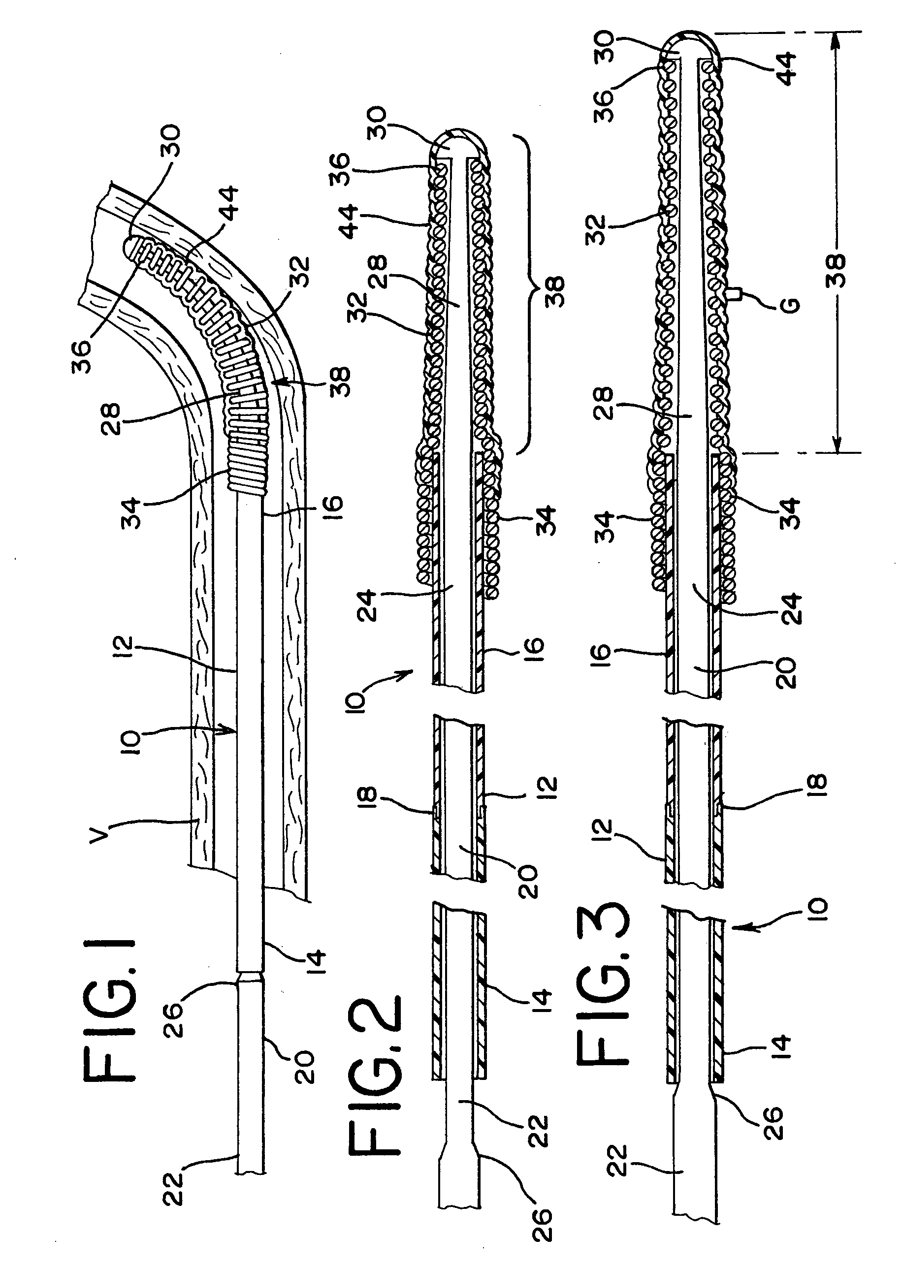 Variable stiffness guidewire