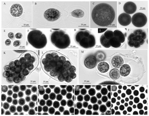 Haematococcus pluvialis JNU 35 with high astaxanthin yield, culture method and application thereof