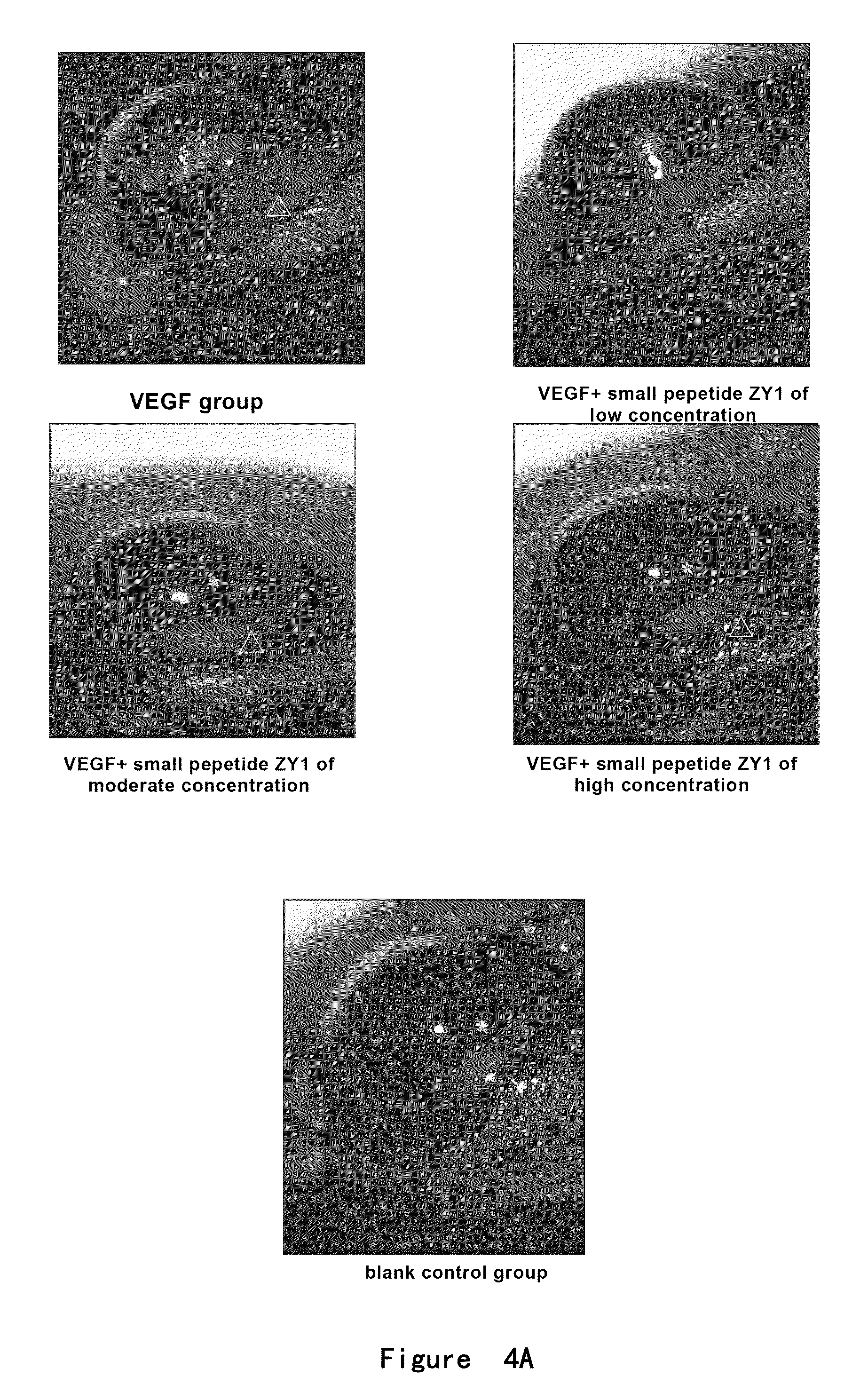 Angiogenesis-inhibiting peptide and application thereof