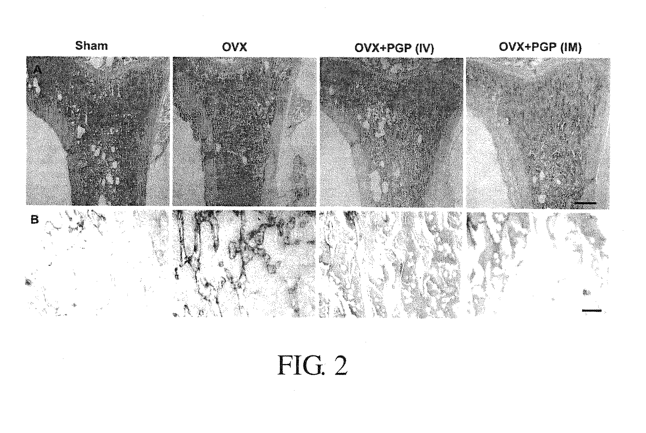 Polypeptides Selective for avB3 Integrin, Including Pegylated Polypeptides, And Pharmaceutical Uses Thereof