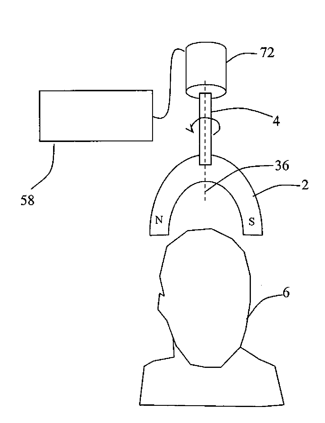 Systems and Methods for Depression Treatment Using Neuro-EEG Synchronization Therapy