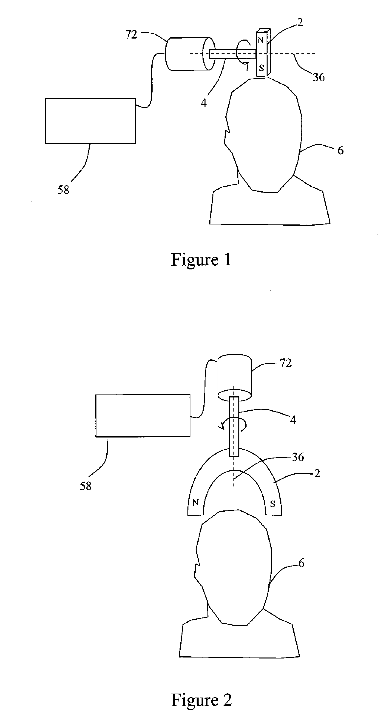 Systems and Methods for Depression Treatment Using Neuro-EEG Synchronization Therapy